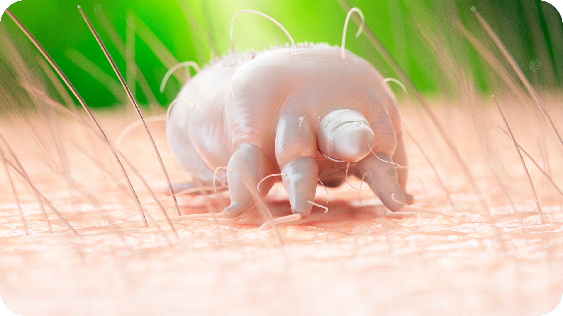 Uyuz Neden Olur, Nasıl Bulaşır?